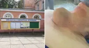 Фото пухлини щитоподібної залози