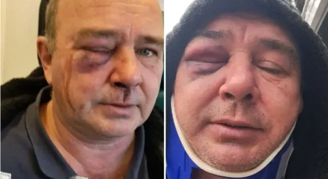 Постраждалий чоловік