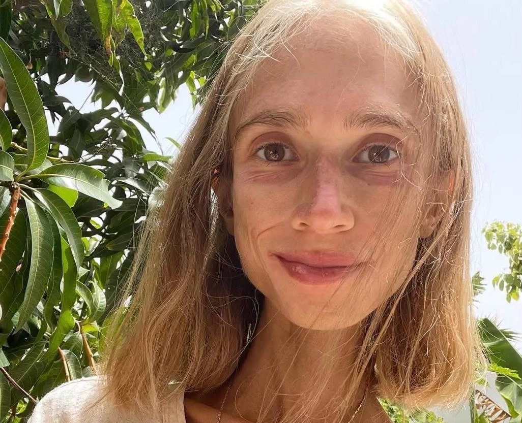 Полячка Кароліна Кшижак, яка їла лише фрукти померла від виснаження на Балі
